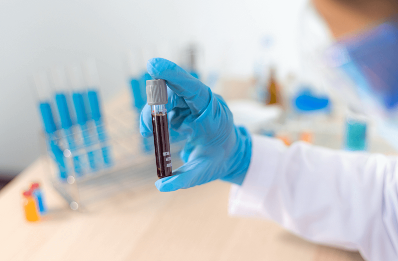 Laboratóriumi kémcső vérmintával OGTT vizsgálathoz